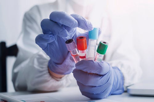 Incoming Lab Reinventing Pre-Analytical Processes | Core Laboratory at Abbott