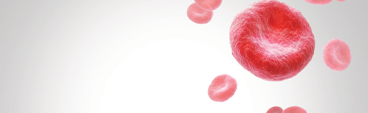 anemia Image