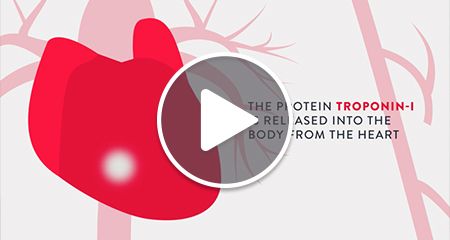 troponin preview image