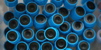 Bild: Blutröhrchen mit blauem Verschluss
