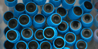 blood vials with  blue caps image