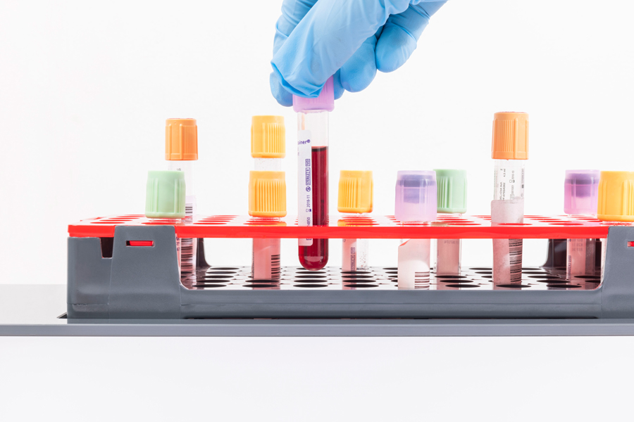 Sample archiving efficiency image