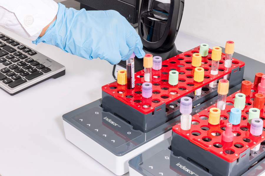 Prioritize urgent samples image