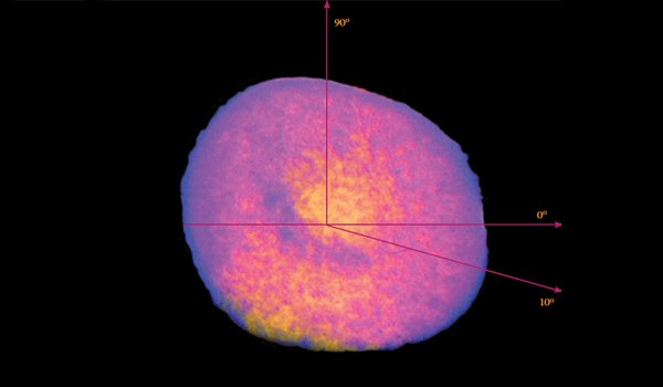 Análisis tridimensional de eritrocitos del analizador de hematología CELL-DYN Ruby