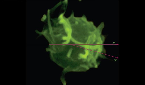 Análisis de trombocitos bidimensional del analizador de hematología CELL-DYN Ruby
